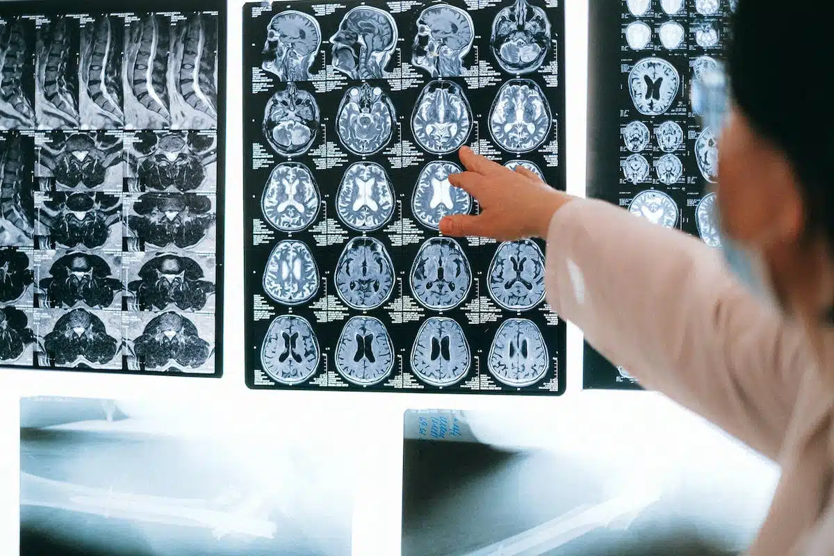 senior brain